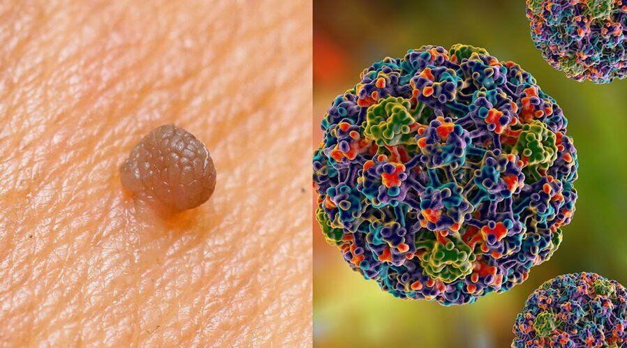 Cesty prenosu HPV