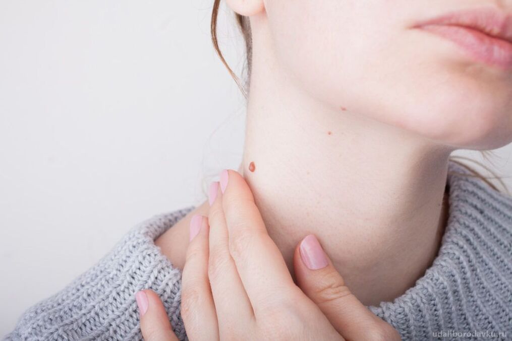 Patogenéza HPV