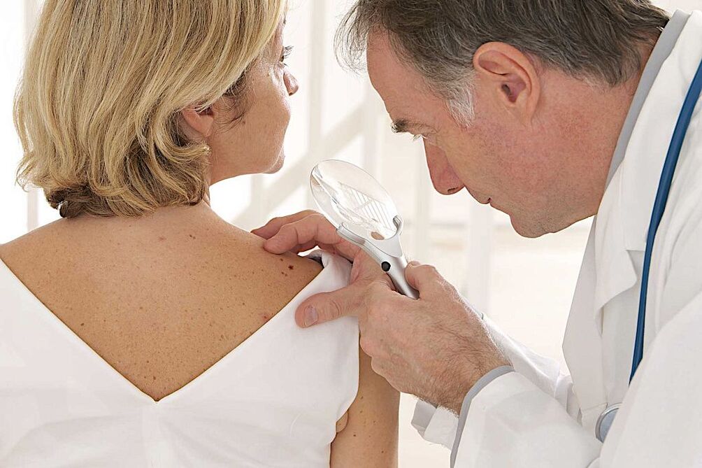 diagnostika ľudského papilomavírusu